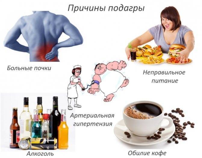 Кофе при подагре: можно пить или нет, замена на цикорий