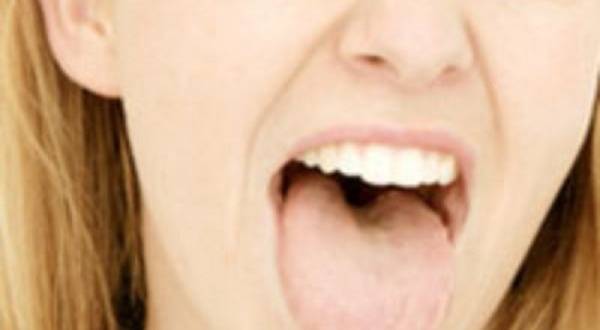 Белый налет на языке. почему бывает обложен язык? к какому врачу обратиться при налете на языке?
