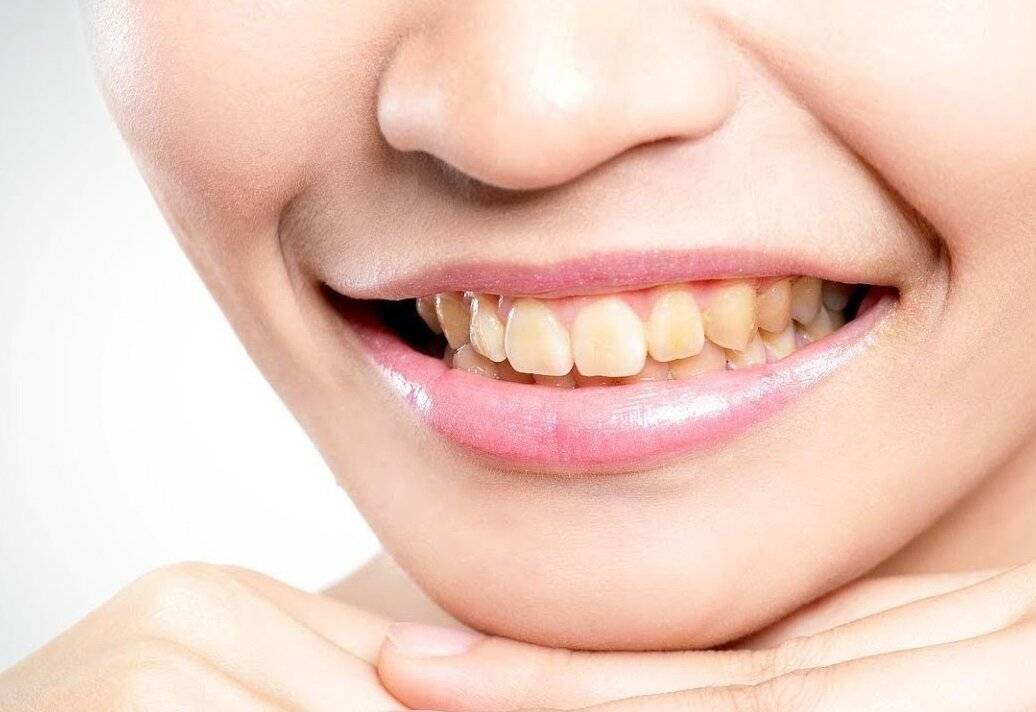 Какие продукты окрашивают зубы?