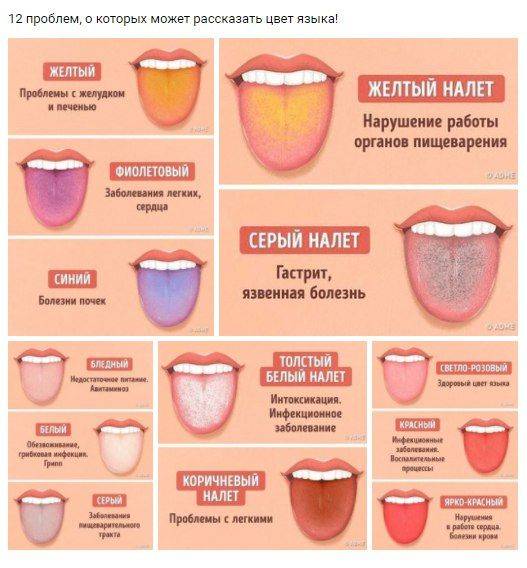 Как надолго сохранить  белизну зубов